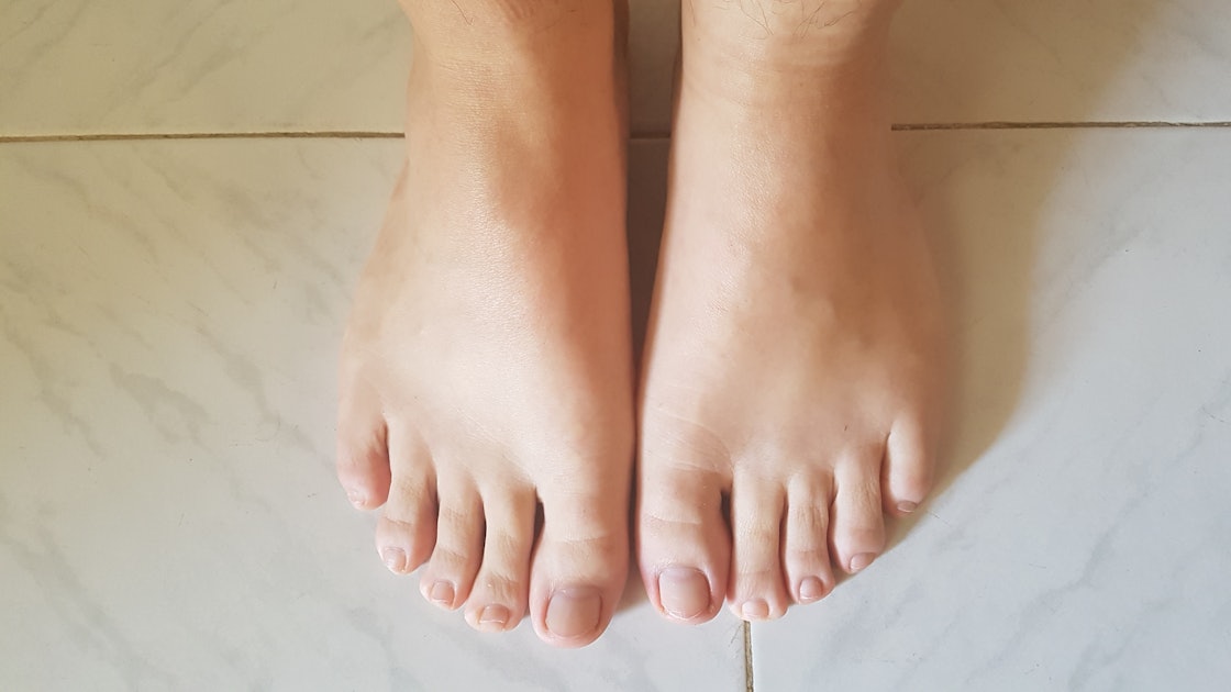 swollen feet after delivery symptoms