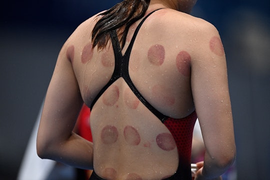 Marks from cupping therapy are pictured on the back of a swimmer ahead of a swimming event during th...
