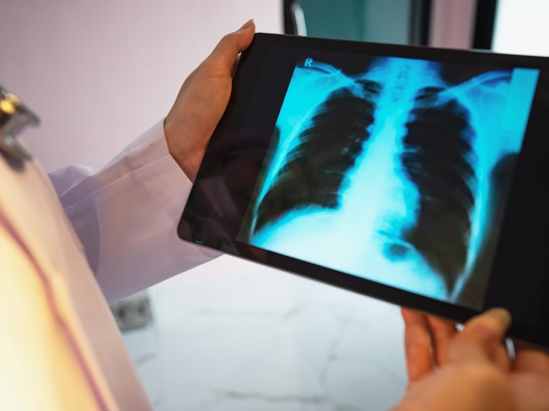 doctor checking chest x-ray film at ward hospital.