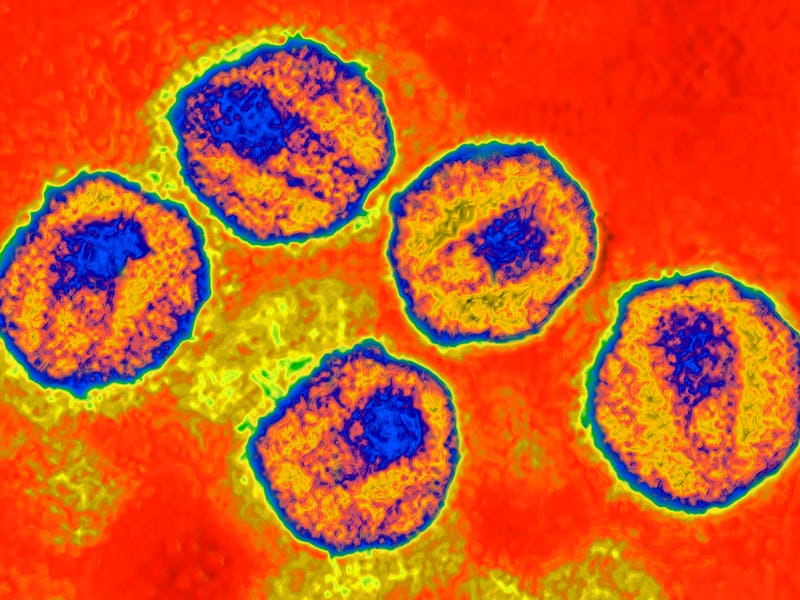 HIV virus. Image produced from an image taken with transmission electron microscopy. Viral diameter ...