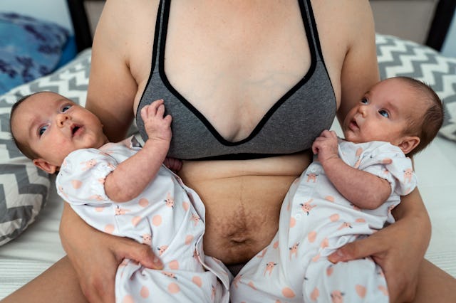 Mother with stretch marks on her abdomen from pregnancy with her babies