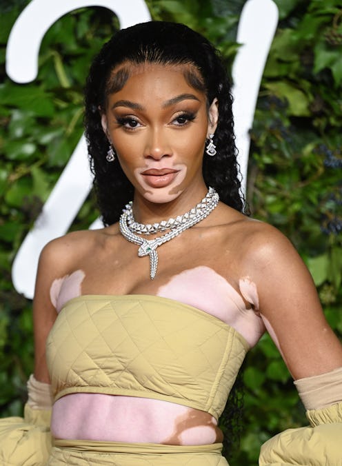 Winnie Harlow
