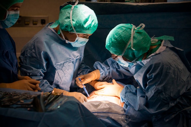 c-section delivery of a baby in a hospital