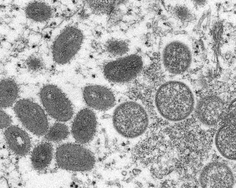Electron microscope image of various virions (virus particles) of the monkeypox virus taken from hum...