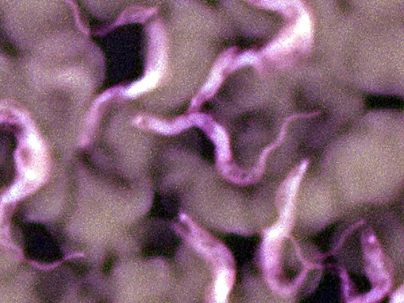 Trypanosoma, A Blood Parasite And The Causative Agent Of Sleeping Sickness Trypanosomiasis Transmitt...