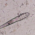 MUNICH, GERMANY - NOVEMBER 26: Demodex mite (Demodex canis) in the institute for parasitology of the...