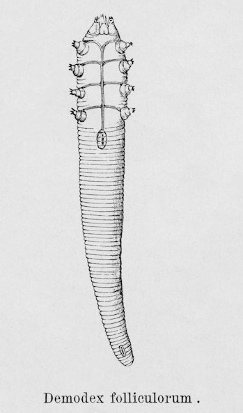 A scientific illustration of Demodex folliculorum