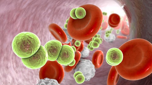 Illustration of meningococcemia, the dissemination of bacteria Neisseria meningitidis into the blood...
