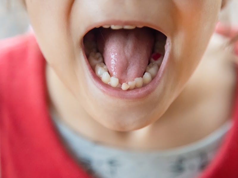 The kid had a baby tooth. Selective focus.