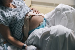 The NHS has experienced a shortage in epidural kits and Remifentanil.