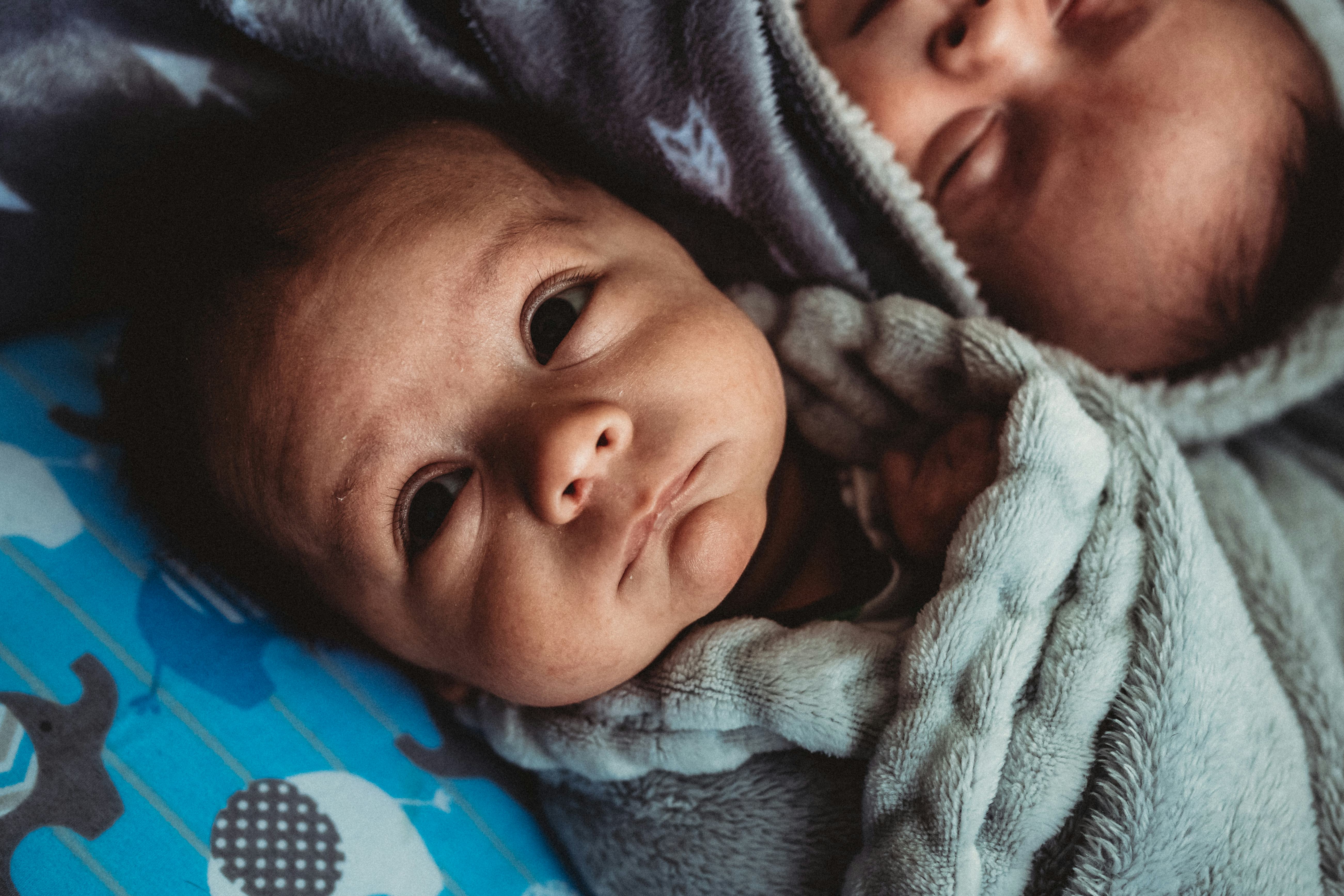 Can Twins Hide In Ultrasounds? An Expert Explains