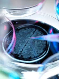 Brain scan in a petri dish illustrating research into Alzheimers and other brain disorders.