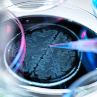 Brain scan in a petri dish illustrating research into Alzheimers and other brain disorders.