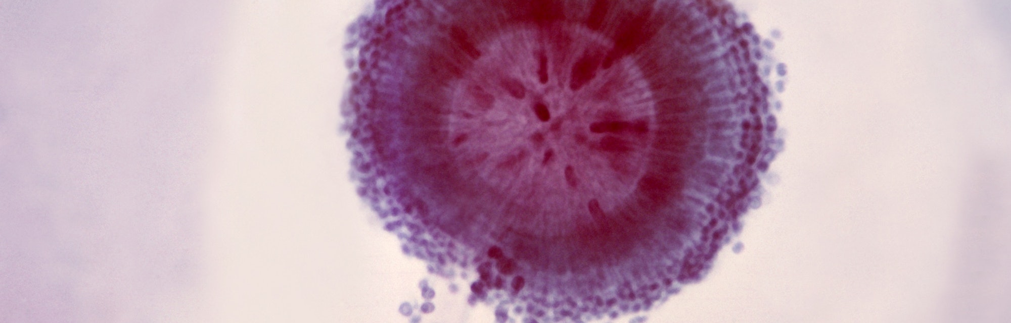 Photomicrograph of the conidial head of an Aspergillus niger fungus, showing a double row of sterigm...