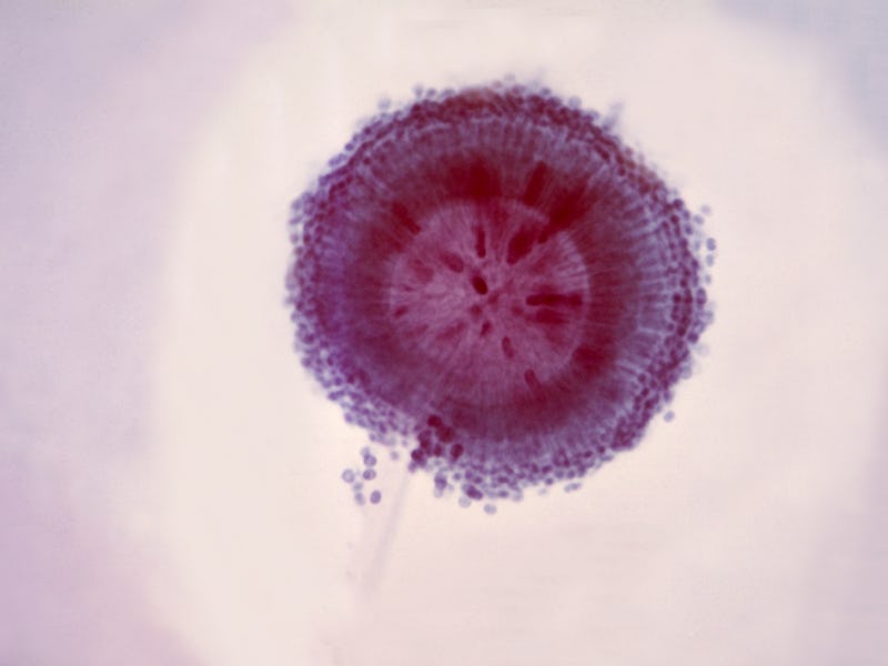 Photomicrograph of the conidial head of an Aspergillus niger fungus, showing a double row of sterigm...