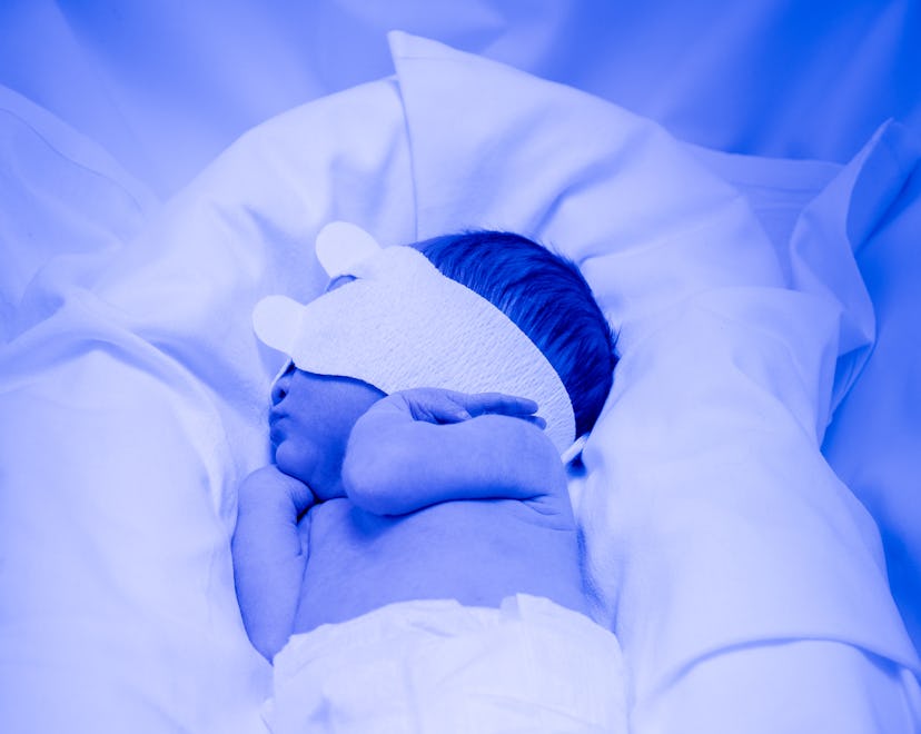 A premature infant being treated for bilirubin in an incubator. She is lying on her side wearing onl...