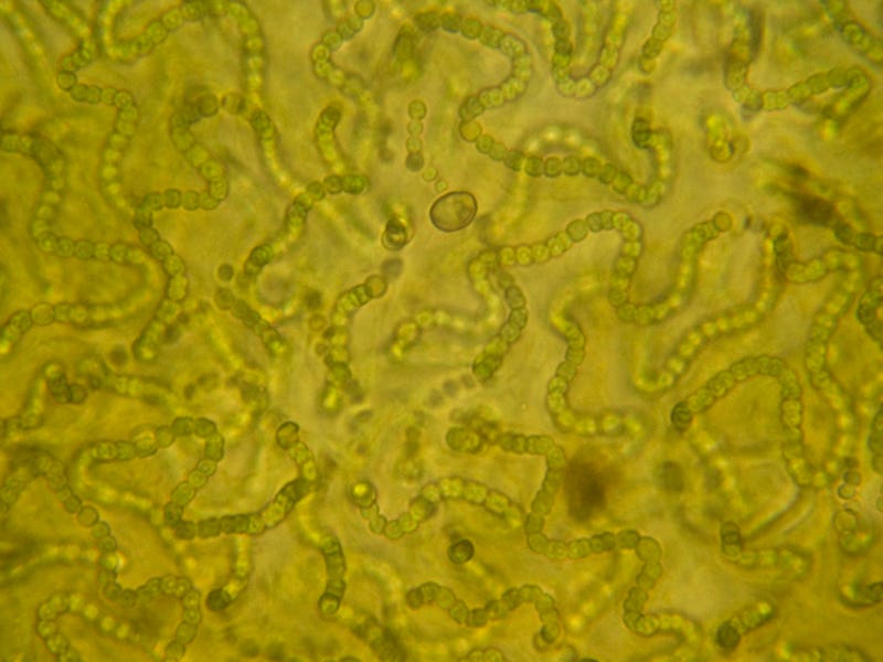 Colony of nostoc bacteria, which could be engineered to create solar energy.