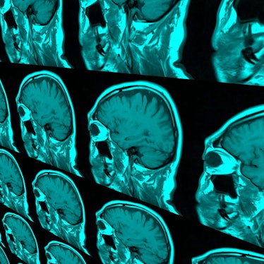 Sagittal coloured magnetic resonance imaging (MRI) of a human brain