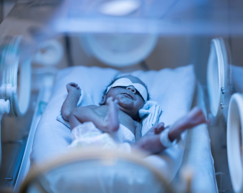 Newborn baby alone in the NICU incubator getting treated for jaundice under ultravioleght light.