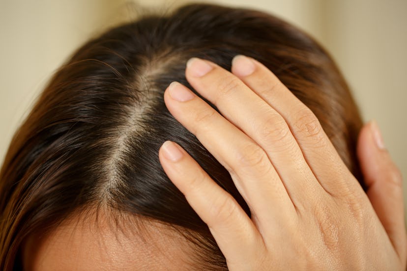 A woman has problems with hair and scalp