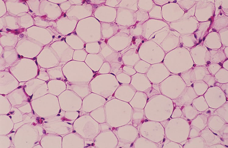 Fat cells, illustration.