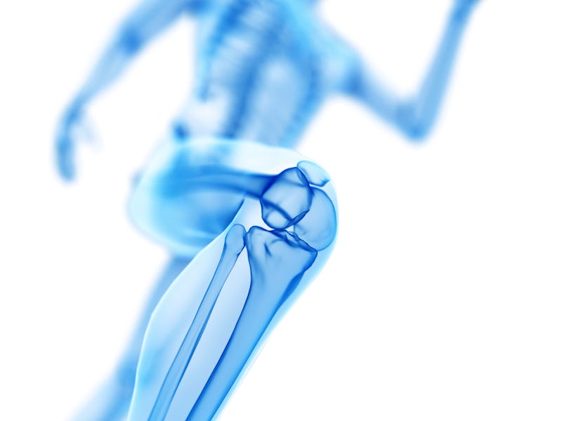 Runner's knee, illustration.