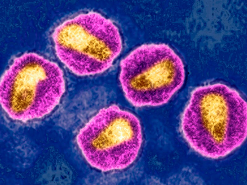HIV virus. Image produced from an image taken with transmission electron microscopy. Viral diameter ...