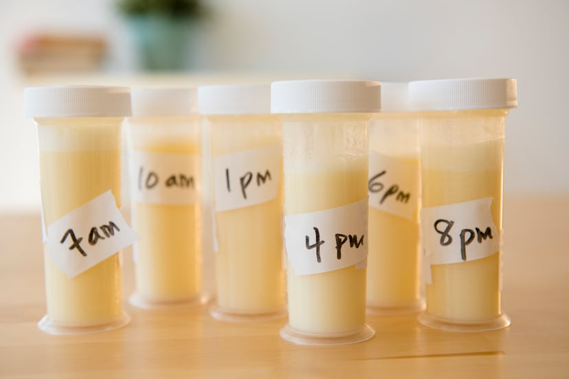 vials of pumped and labeled breast milk in article about combination feeding breast milk and formula...