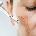 Unrecognizable female suffering from hyperpigmentation (melasma) is about to use face serum for skin...