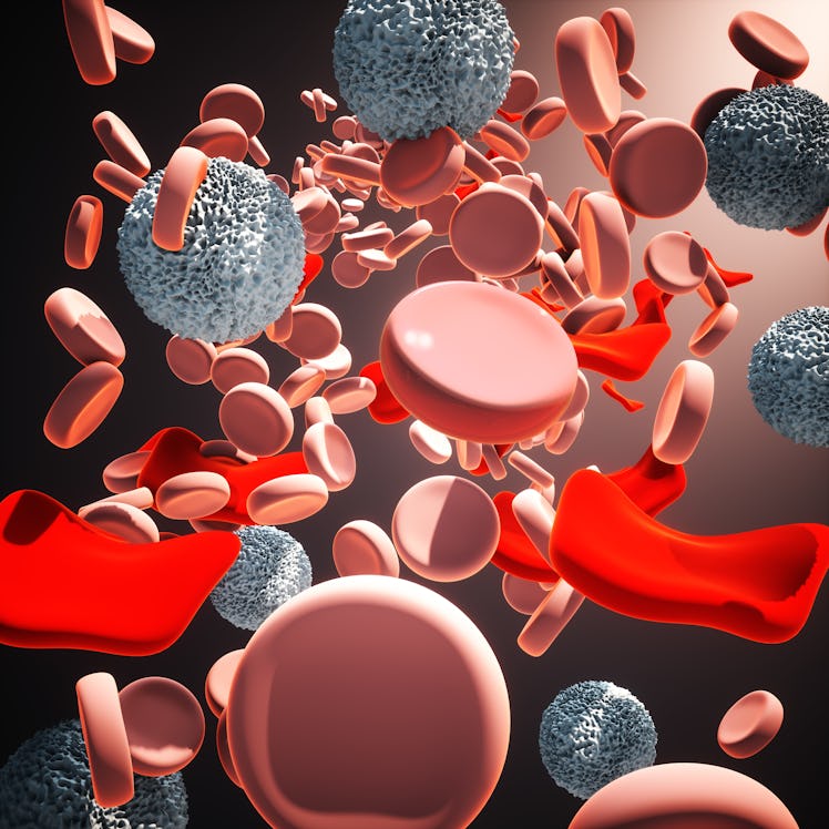 Illustration showing malformed red blood cells in thalassemia. Thalassemia is an inherited blood dis...