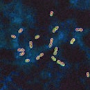Pneumococcal bacteria (streptococcus pneumoniae). Pneumococcus is an important pathogen in humans. I...