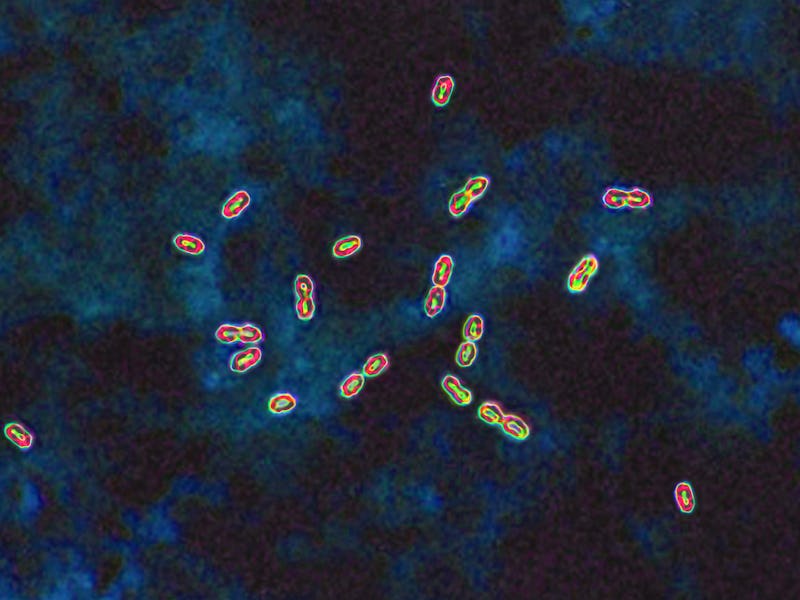 Pneumococcal bacteria (streptococcus pneumoniae). Pneumococcus is an important pathogen in humans. I...