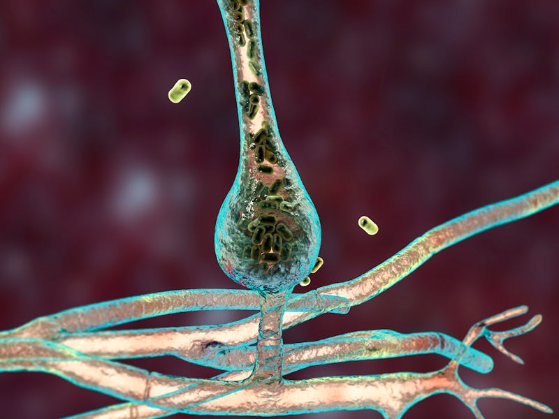 Saksenaea microscopic fungi, computer illustration. Saksenaea vasiformis causes mucormycosis disease...