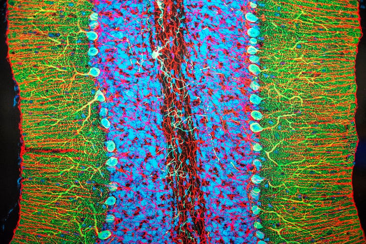 Cerebellar Purkinje neurons. Brain exhibition Inside MIT Museum Building at 265 Massachusetts Avenue...