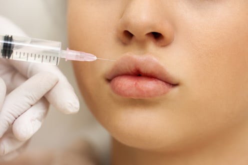 facial balancing with fillers
