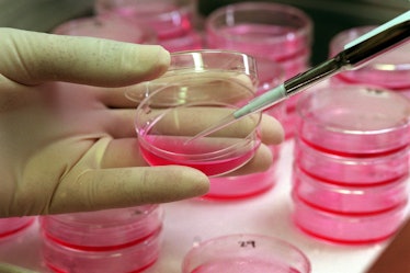 Dr. Hany Abdel-Hafiz injects DNA into breast cancer cells growing in a medium in a petri dish. He is...
