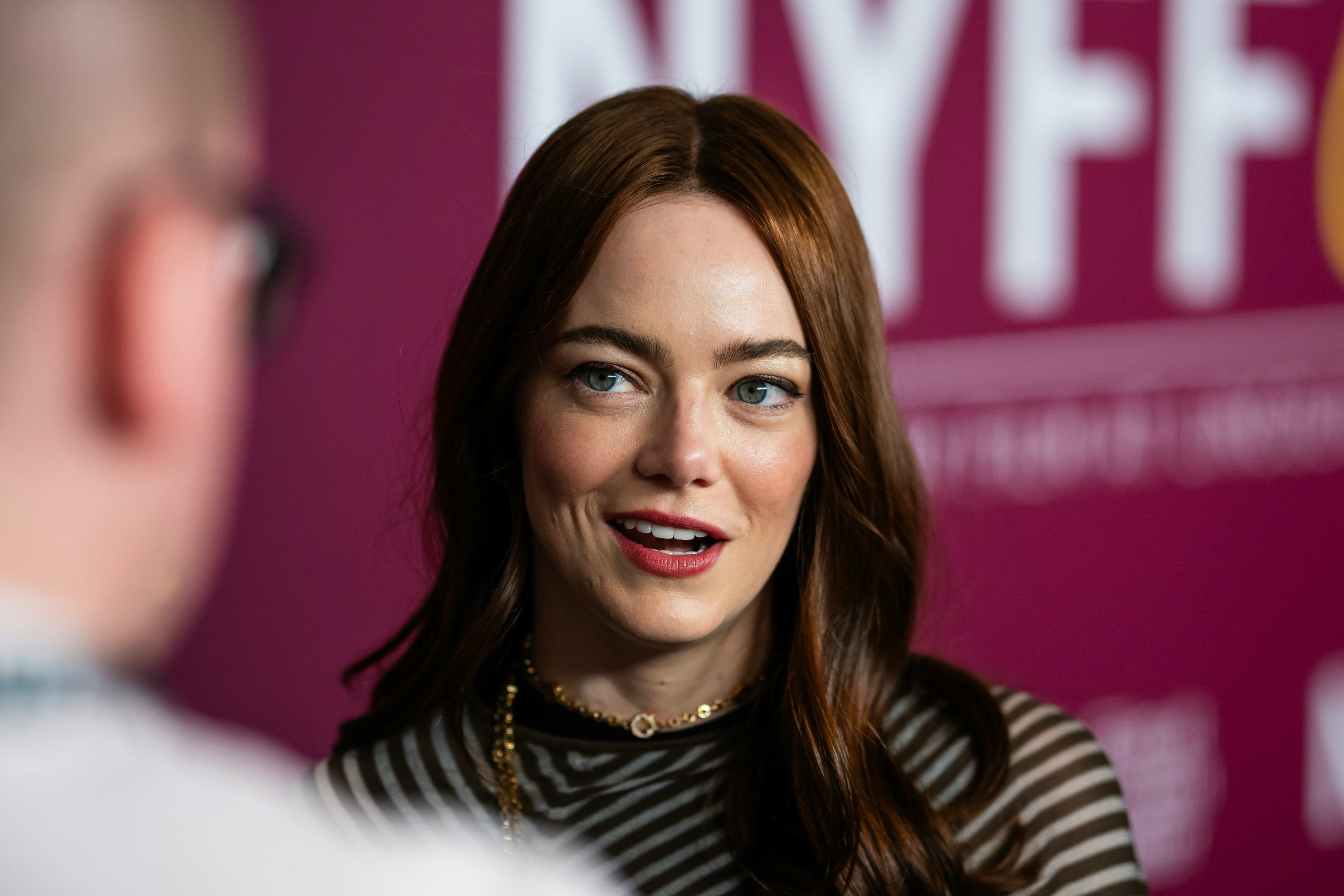 Emma Stone fans think she may have shaved her head.