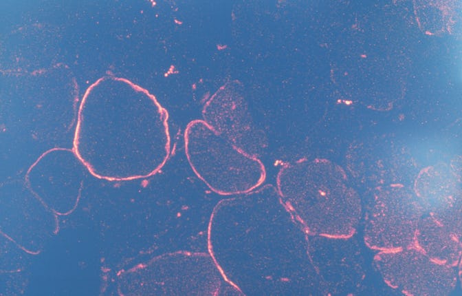 Genetics Research Laboratory. Gene Therapy Requires A Gene Drug And A Vector To Carry It To The Targ...