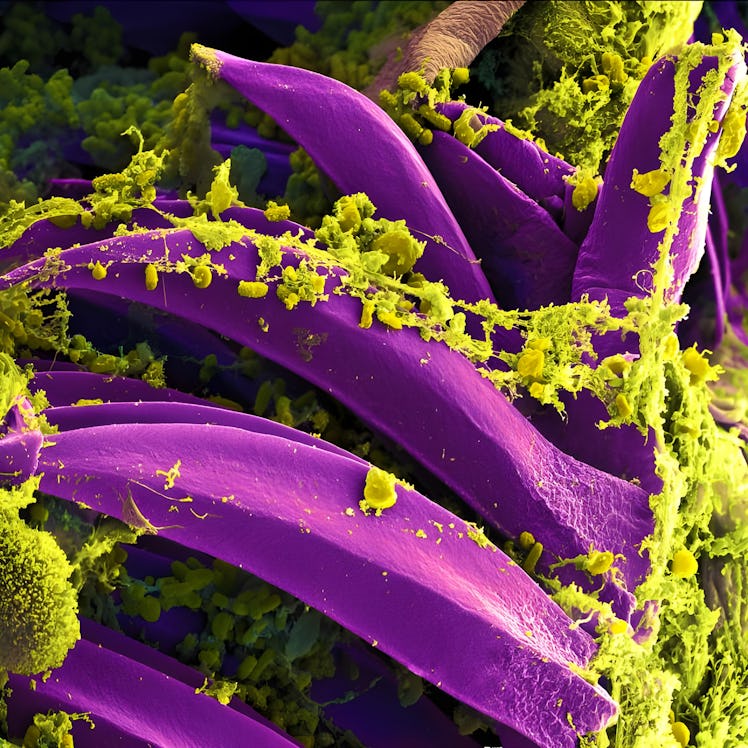 Scanning electron micrograph of Yersinia pestis, which causes bubonic plague, on proventricular spin...