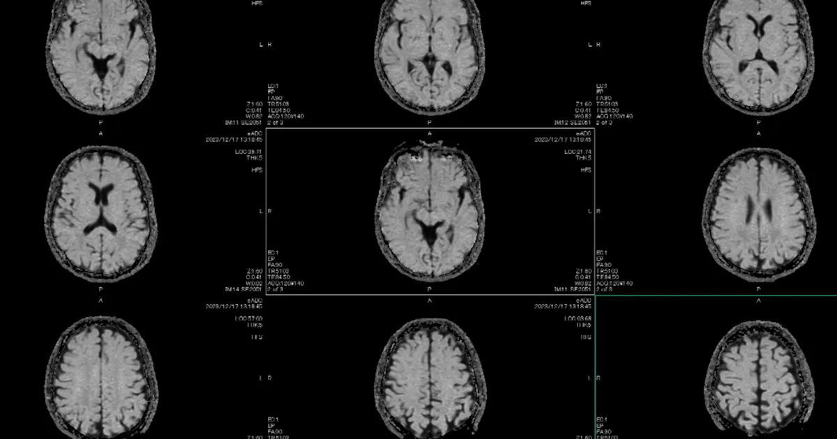 This New Map Of Gene Regulation Could Change The Way We See The Human Brain