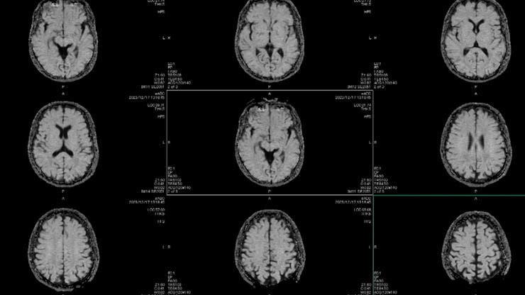Magnetic MRI Scan. Brain. CT scan , digitally generated scans of a human brain ,HUD or graphic displ...