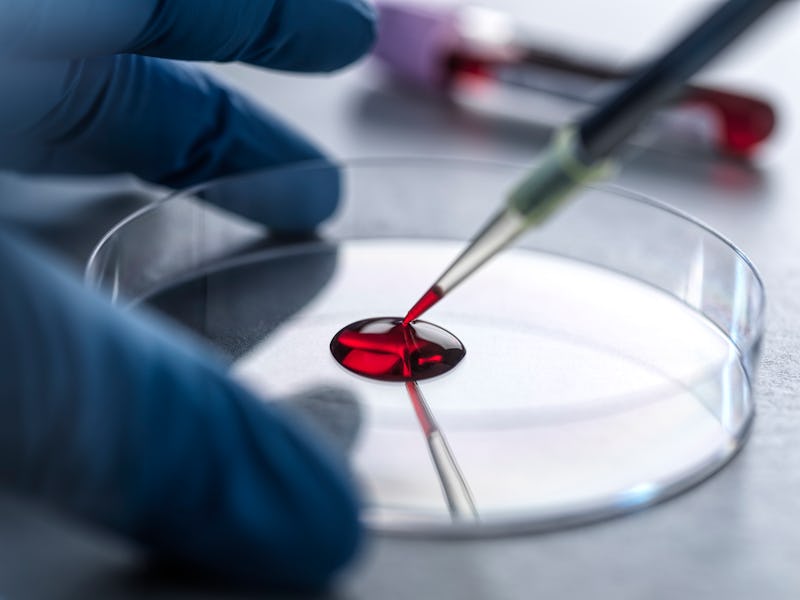 A person in blue gloves uses a pipette to add a red liquid to a Petri dish in a laboratory setting.