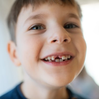 Portrait of a happy child showing hole with missed baby tooth.