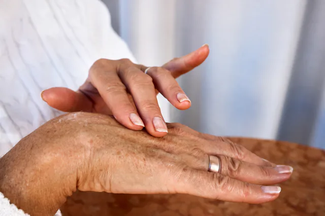 Elderly hands with age spots and wrinkles applying moisturizing cream, close-up of daily skincare ro...