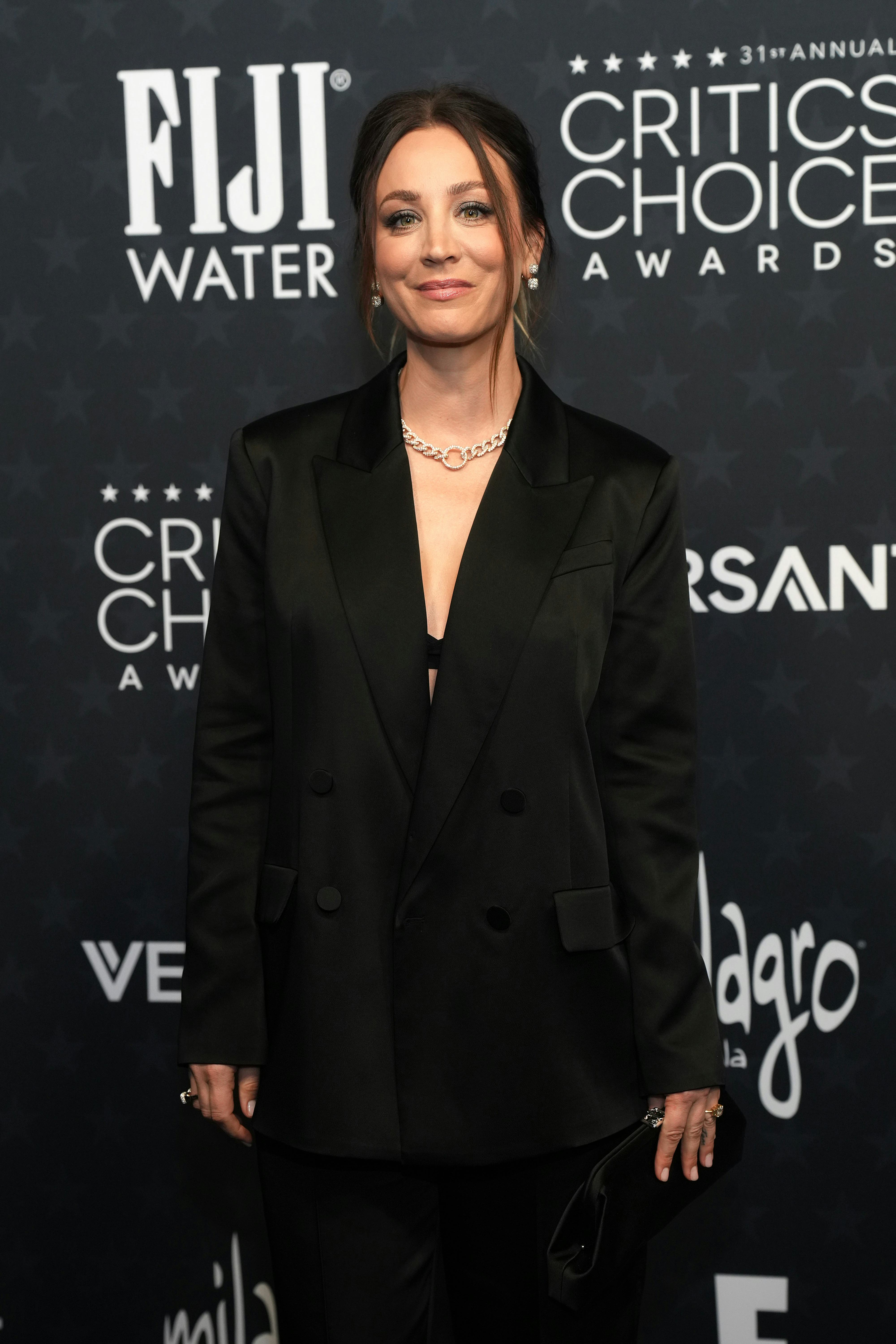 Kaley Cuoco Recalled Her Botox Mishap On 'The Big Bang Theory' Set