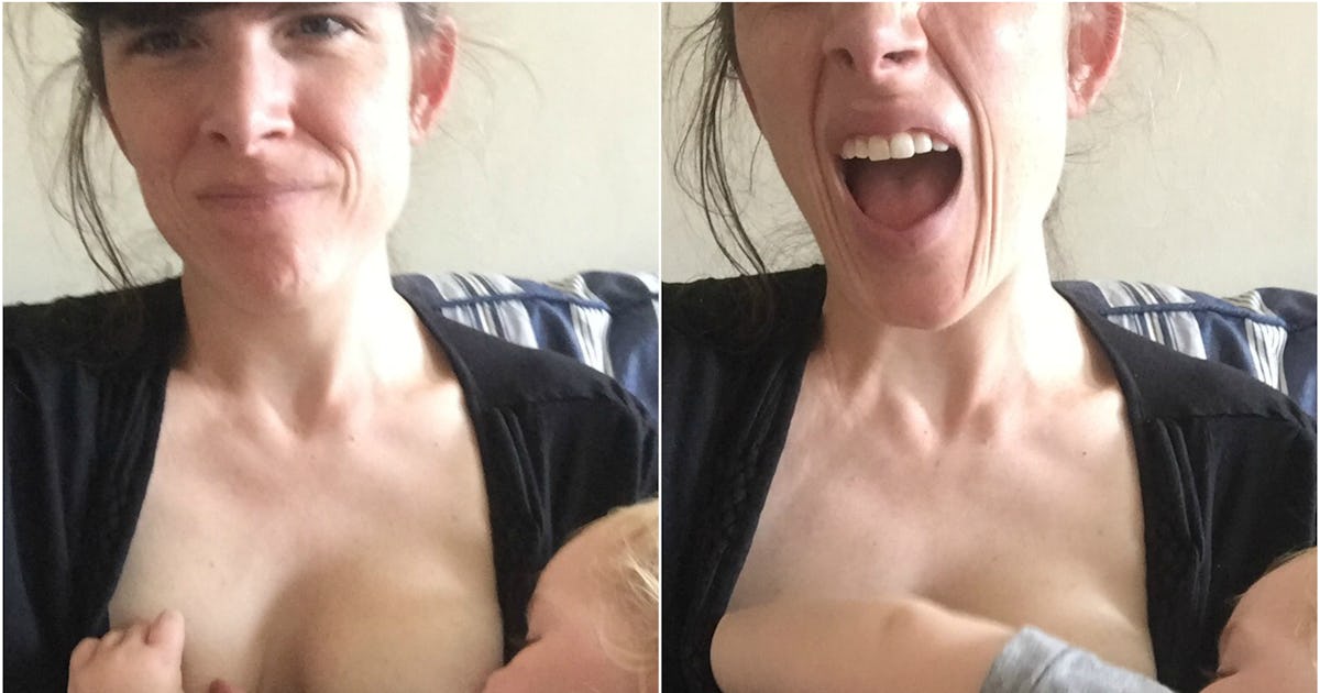 23 Breastfeeding Injuries That Every Nursing Mom Recognizes 23 Breastfeeding Injuries That Every Nursing Mom Recognizes
