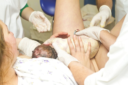 Woman giving birth with doctors standing around her and helping