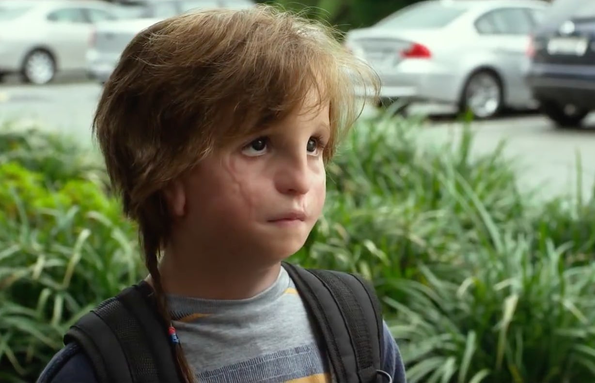 What Condition Does Auggie Have In #39 Wonder? #39 The Heartbreaking Movie What Condition Does Auggie Have In #39 Wonder? #39 The Heartbreaking Movie