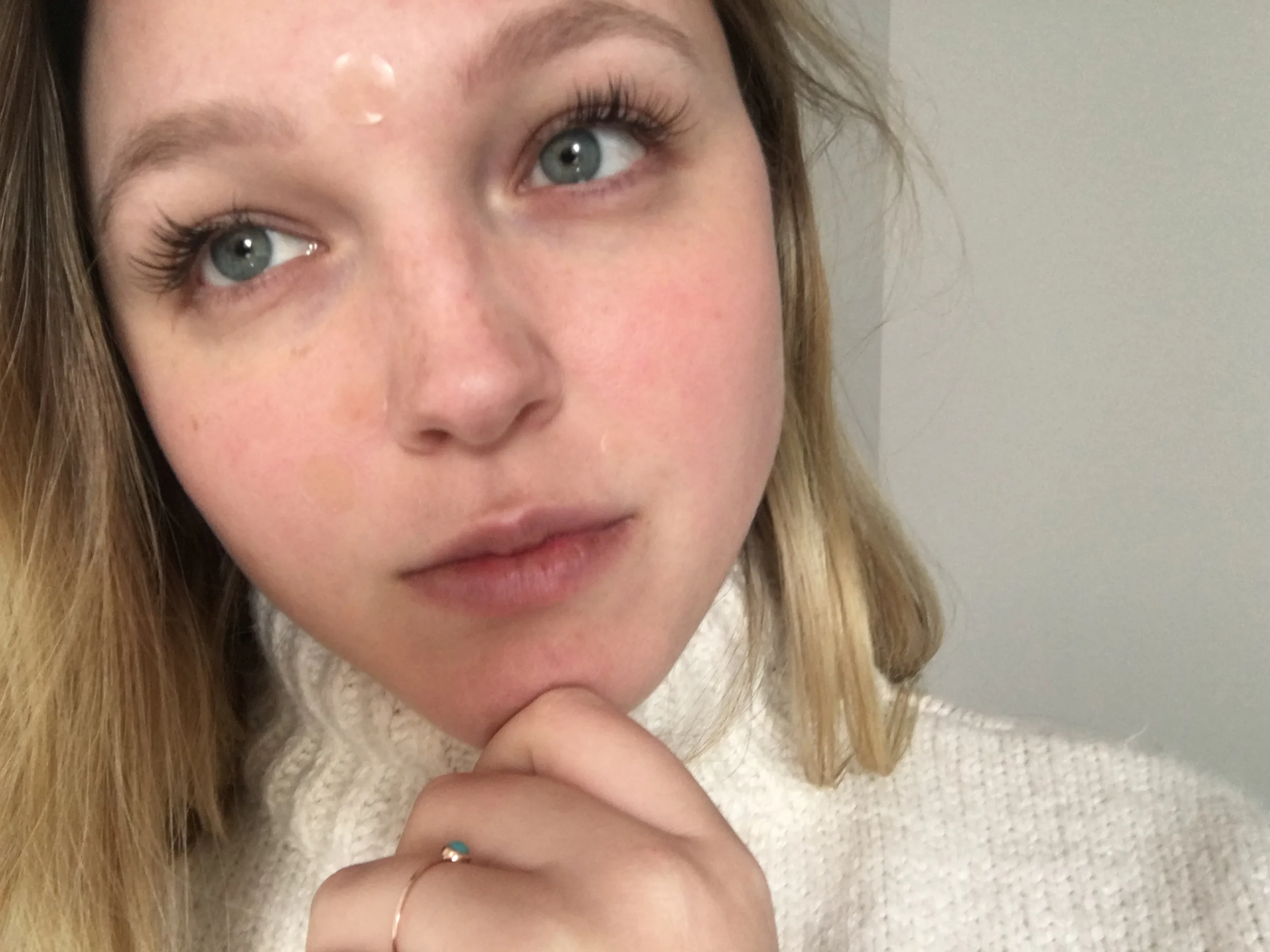 Do Acne Stickers Work