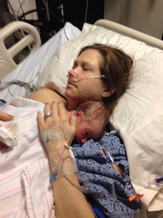 A woman with HELLP Syndrome laying in the hospital bed, holding her just born baby on her chest